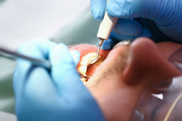 Best Emergency Dental Care for Broken or Chipped Teeth in Philadelphia, MS